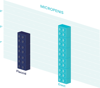 micropenis-infographic